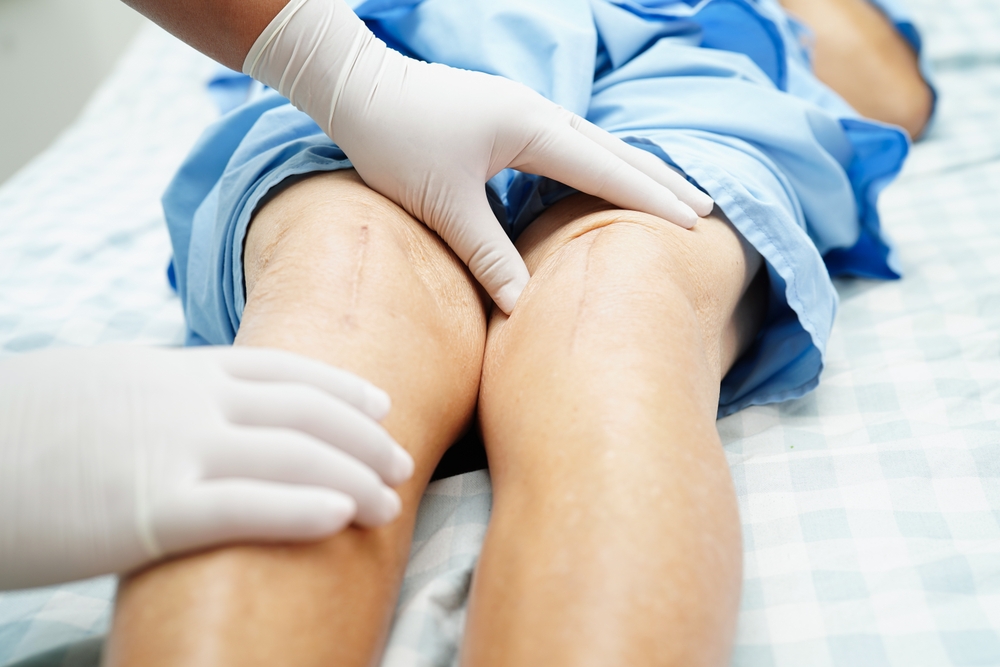 Periferik Arter Hastalığı