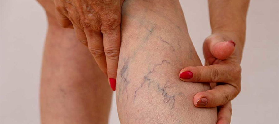 2026 Varis Tedavisi Fiyatları