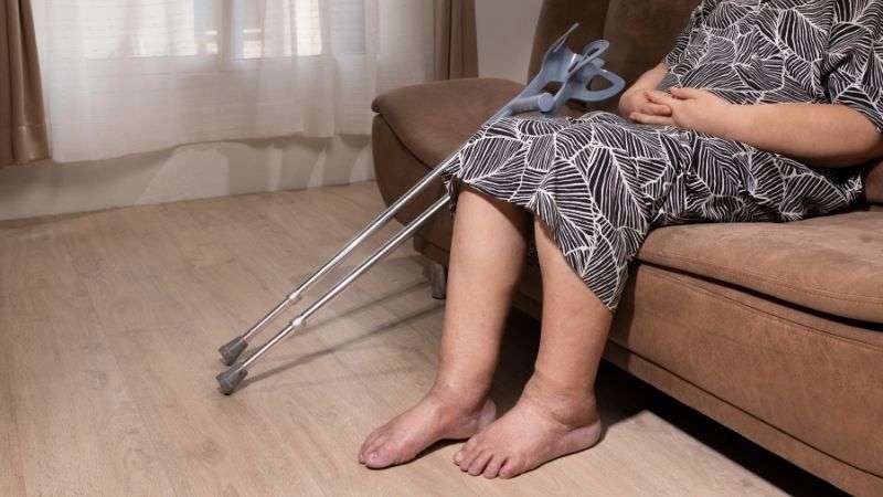 Derin Toplardamar Tıkanıklığı (DVT) Nedir